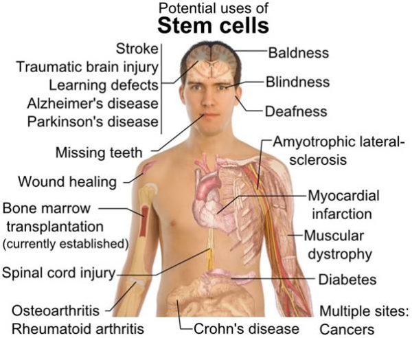 Purtier Stem Cell Diseases
