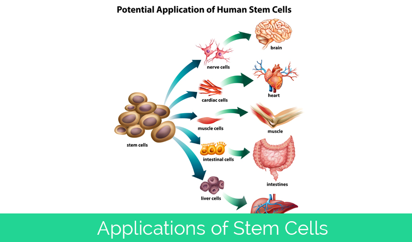 stem cell application purtier placenta